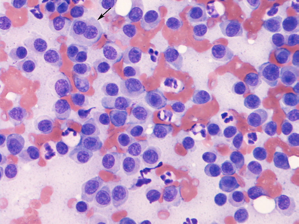 Plasma-cell-tumors-in-dogs