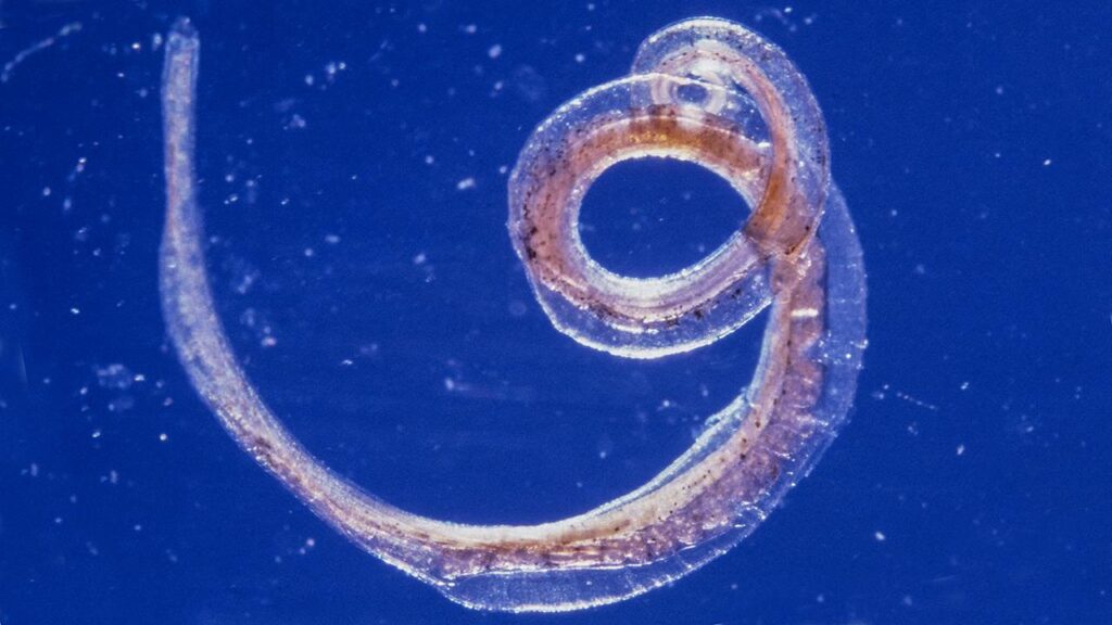 Crohn’s Disease Parasite